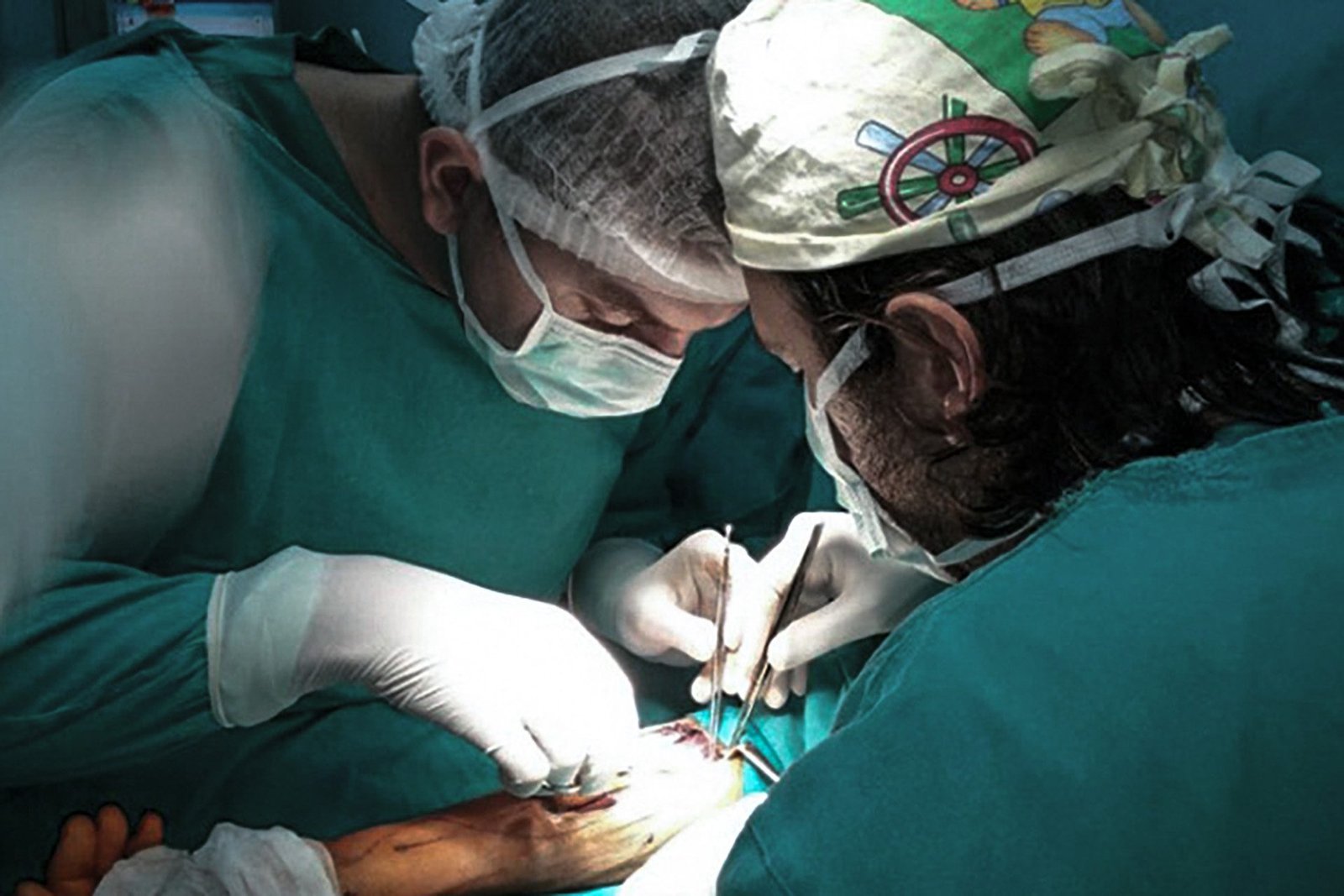 Doktor Nikola Baroš - Šaka u funkciji nakon operacije palca